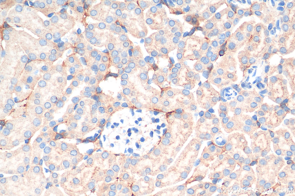Immunohistochemistry (IHC) staining of mouse kidney tissue using Adrenomedullin Polyclonal antibody (10778-1-AP)