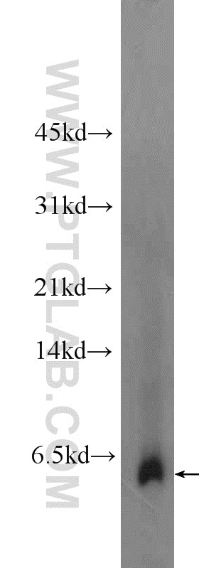 Western Blot (WB) analysis of fetal human brain tissue using Adrenomedullin Polyclonal antibody (10778-1-AP)