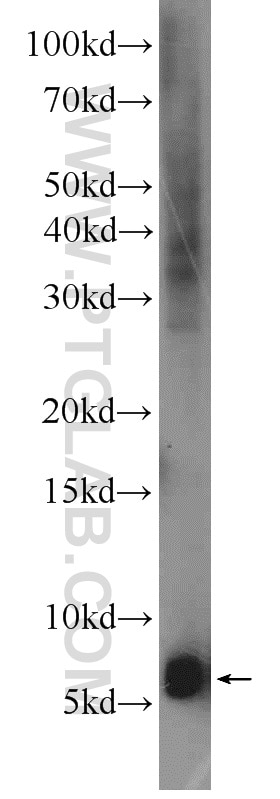 Western Blot (WB) analysis of A549 cells using Adrenomedullin Polyclonal antibody (10778-1-AP)