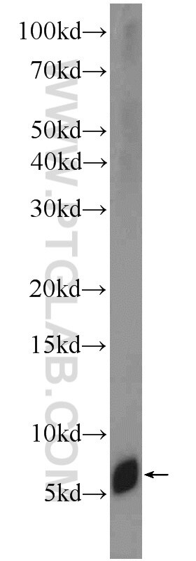 Western Blot (WB) analysis of Raji cells using Adrenomedullin Polyclonal antibody (10778-1-AP)