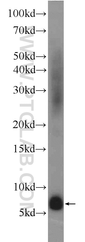 Western Blot (WB) analysis of human kidney tissue using Adrenomedullin Polyclonal antibody (10778-1-AP)