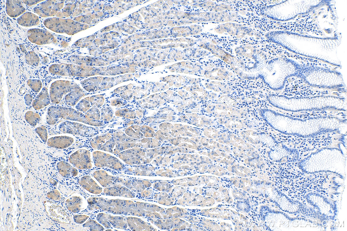 Immunohistochemistry (IHC) staining of human stomach tissue using ADM2 Polyclonal antibody (23781-1-AP)
