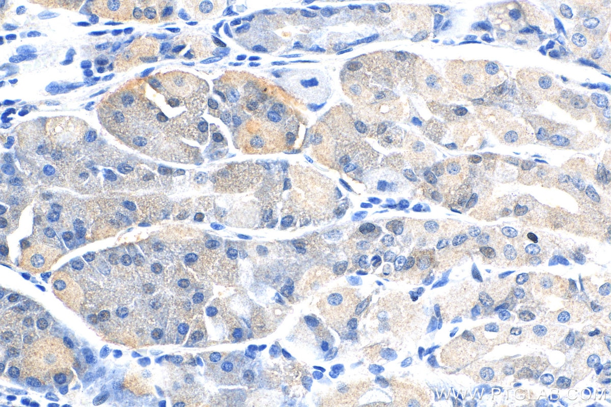 Immunohistochemistry (IHC) staining of human stomach tissue using ADM2 Polyclonal antibody (23781-1-AP)
