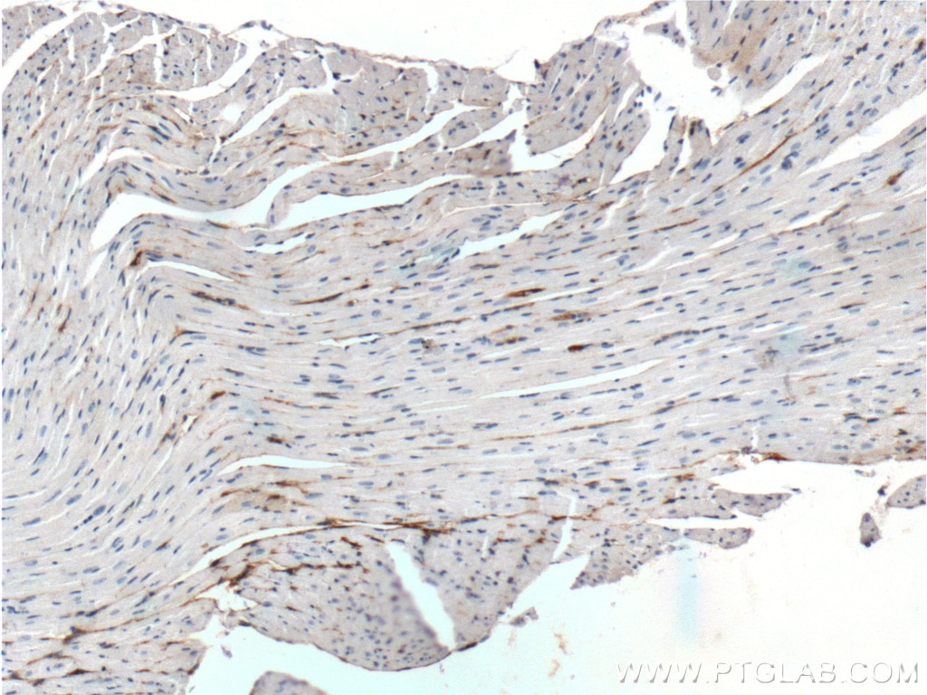 IHC staining of mouse heart using 23781-1-AP