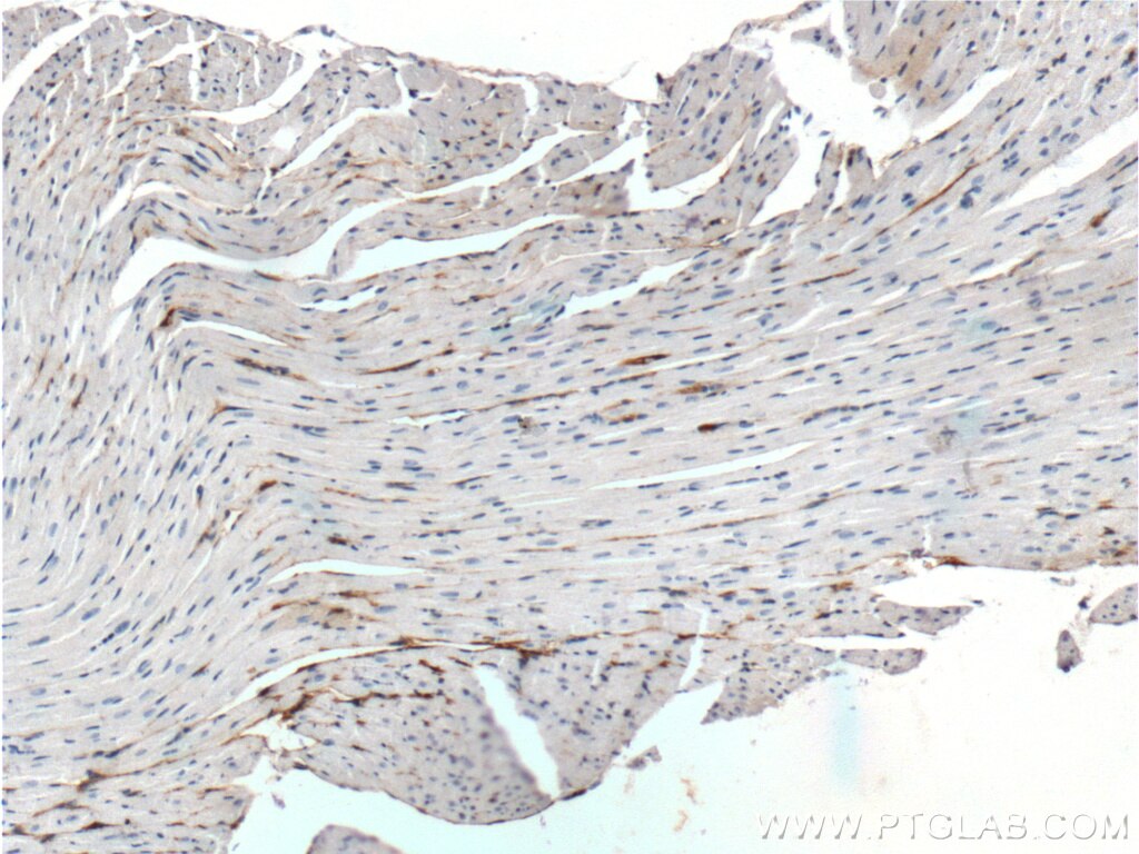 Immunohistochemistry (IHC) staining of mouse heart tissue using ADM2 Polyclonal antibody (23781-1-AP)