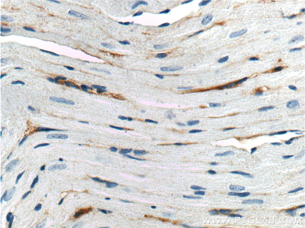 Immunohistochemistry (IHC) staining of mouse heart tissue using ADM2 Polyclonal antibody (23781-1-AP)
