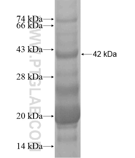 ADM2 fusion protein Ag20548 SDS-PAGE
