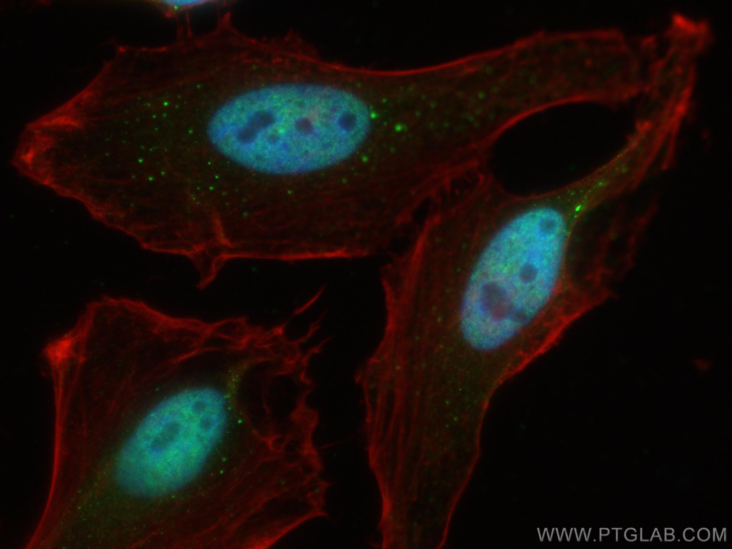Immunofluorescence (IF) / fluorescent staining of HeLa cells using ADNP Polyclonal antibody (17987-1-AP)