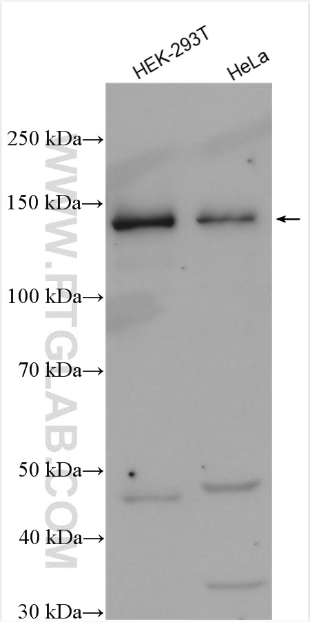 Western Blot (WB) analysis of various lysates using ADNP Polyclonal antibody (17987-1-AP)