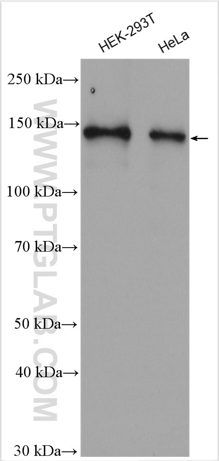 Western Blot (WB) analysis of various lysates using ADNP Polyclonal antibody (17987-1-AP)