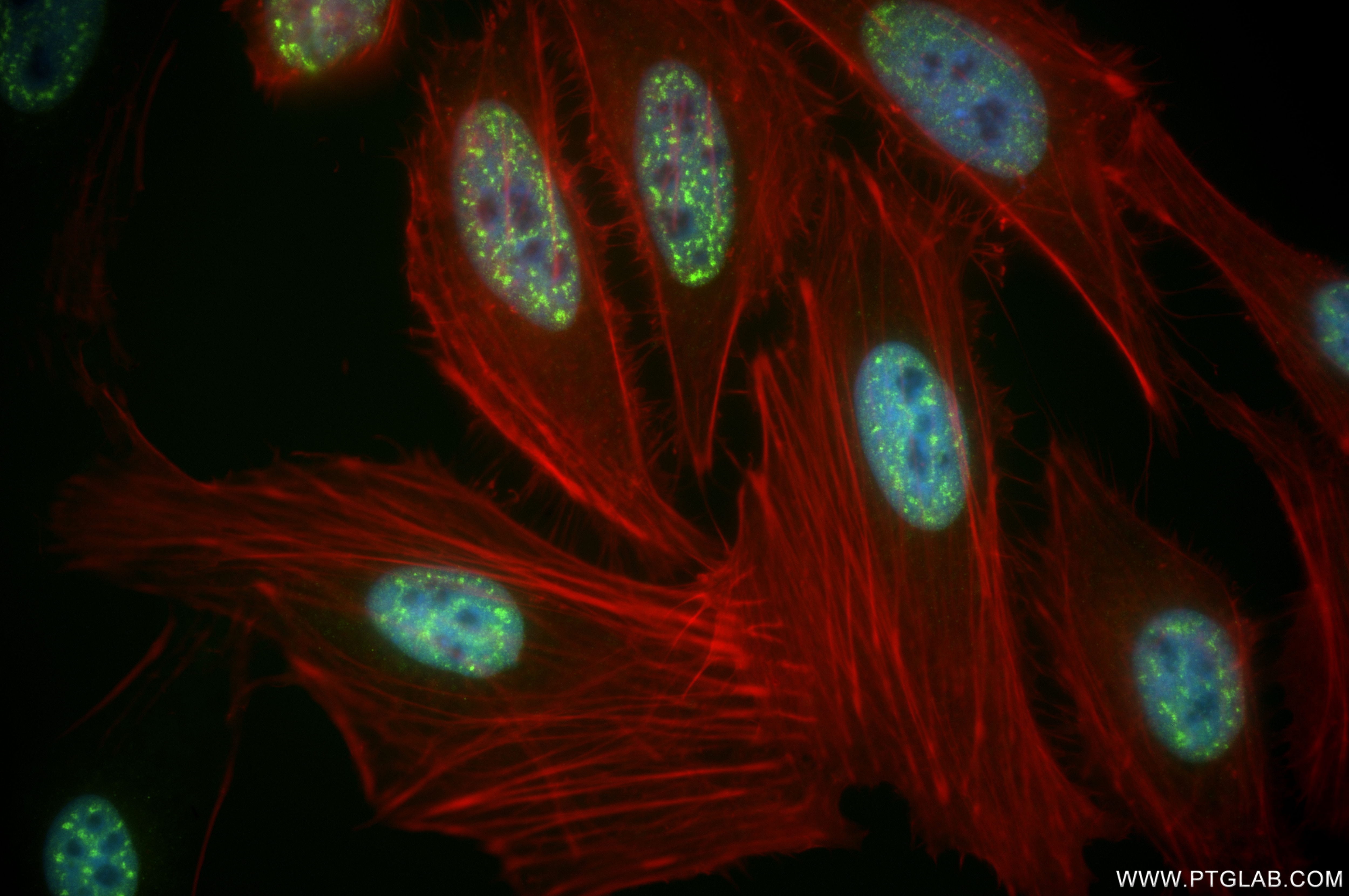 Immunofluorescence (IF) / fluorescent staining of HeLa cells using ADNP Recombinant antibody (85054-2-RR)
