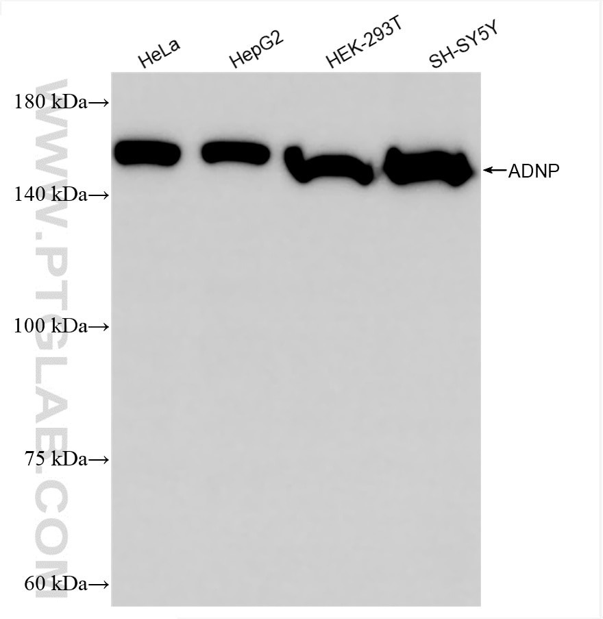 Western Blot (WB) analysis of various lysates using ADNP Recombinant antibody (85054-2-RR)