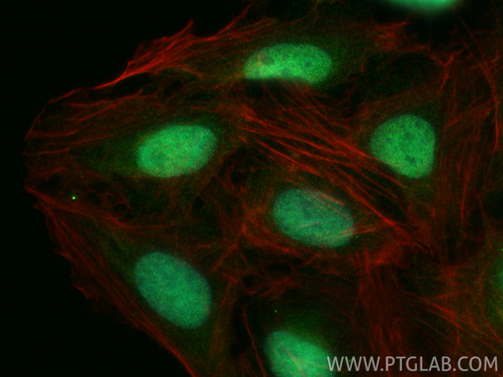 Immunofluorescence (IF) / fluorescent staining of U2OS cells using ADNP2 Polyclonal antibody (17860-1-AP)
