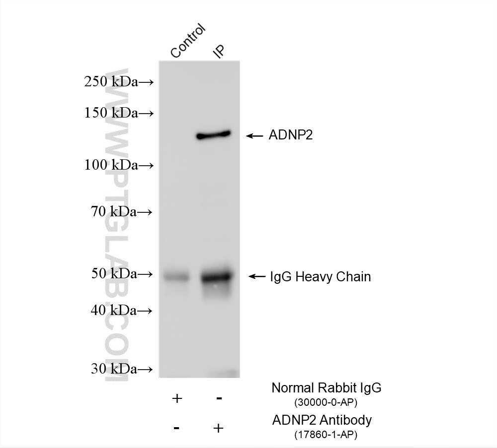 Immunoprecipitation (IP) experiment of U2OS cells using ADNP2 Polyclonal antibody (17860-1-AP)