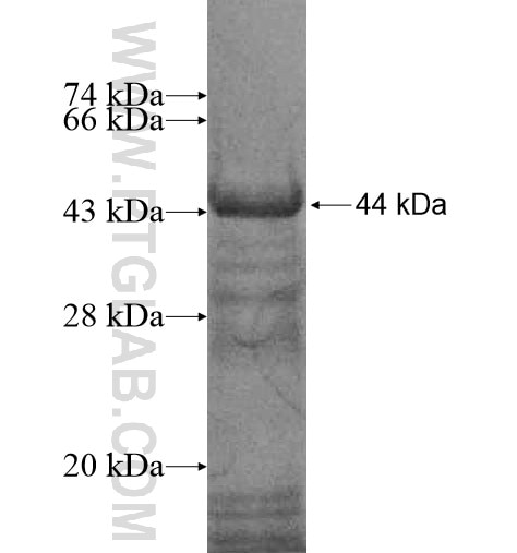 ADNP2 fusion protein Ag12067 SDS-PAGE