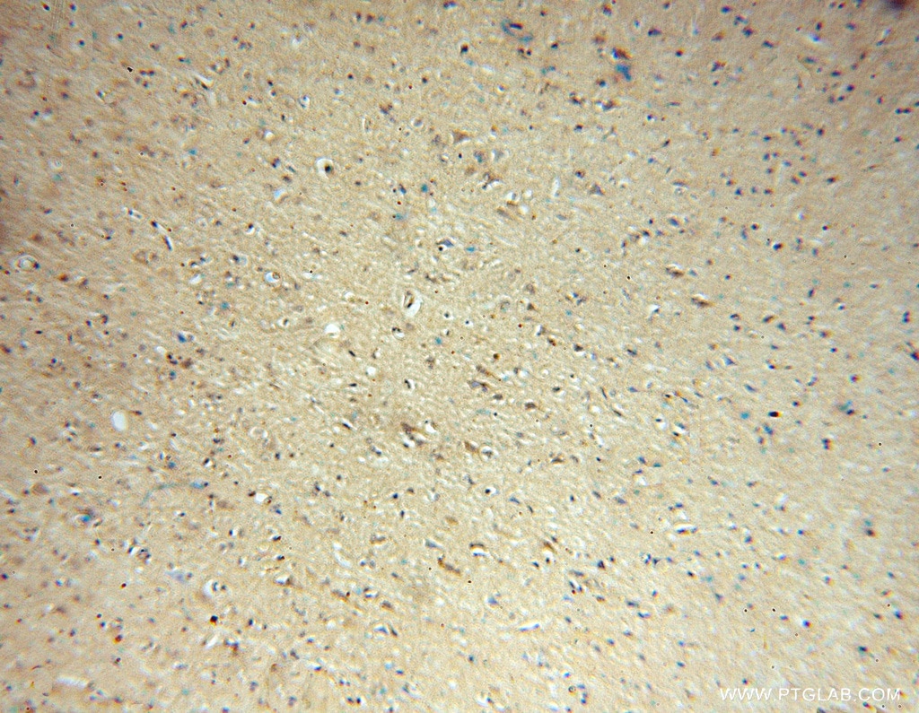 Immunohistochemistry (IHC) staining of human brain tissue using ADO Polyclonal antibody (16479-1-AP)