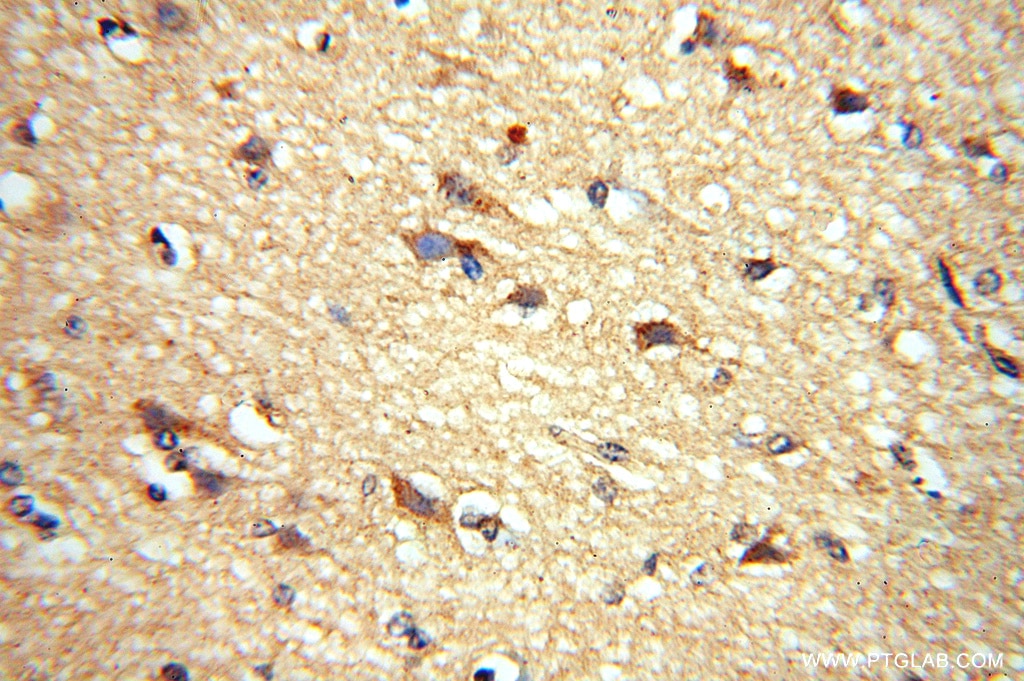 Immunohistochemistry (IHC) staining of human brain tissue using ADO Polyclonal antibody (16479-1-AP)