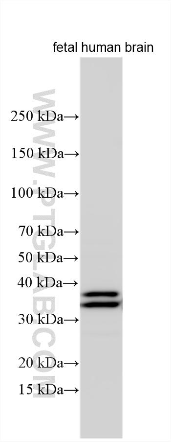 Western Blot (WB) analysis of various lysates using ADO Polyclonal antibody (16479-1-AP)
