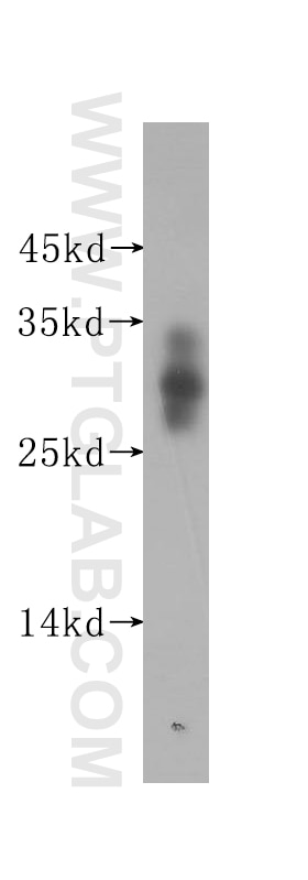 Western Blot (WB) analysis of human brain tissue using ADO Polyclonal antibody (16479-1-AP)
