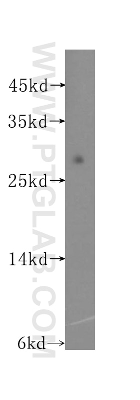 Western Blot (WB) analysis of mouse spleen tissue using ADO Polyclonal antibody (16479-1-AP)