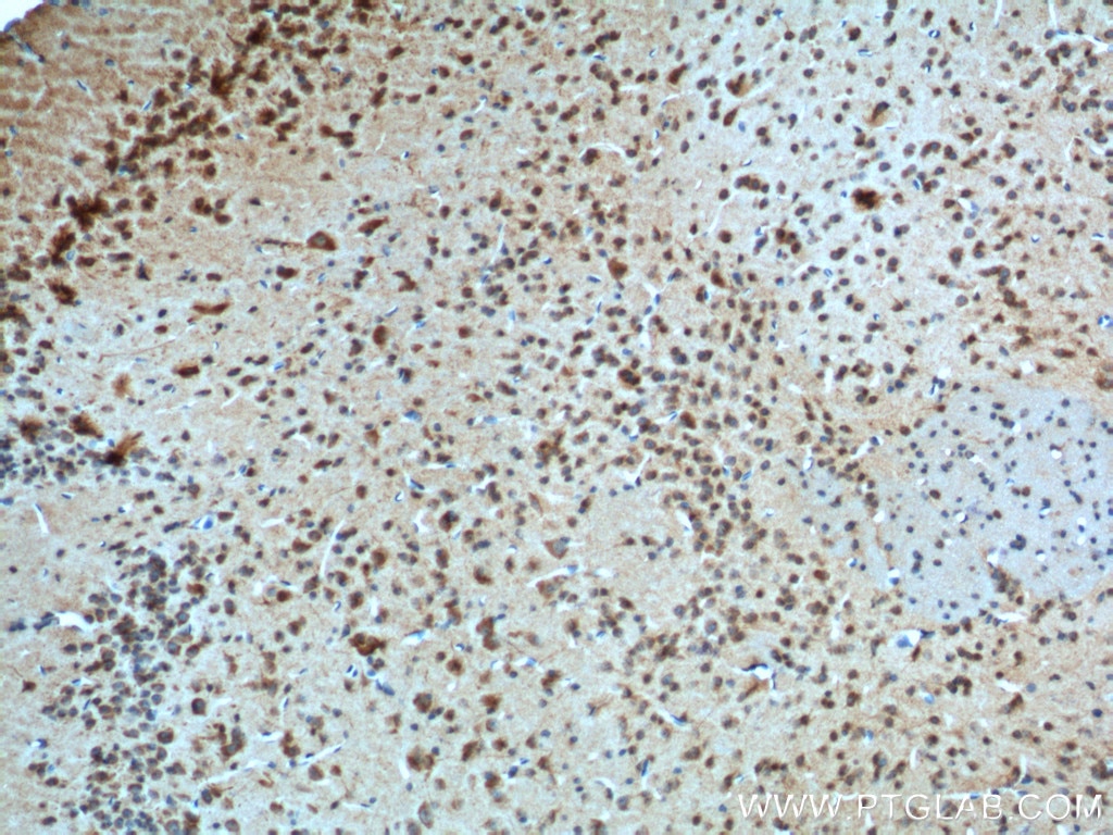 IHC staining of mouse brain using 20332-1-AP