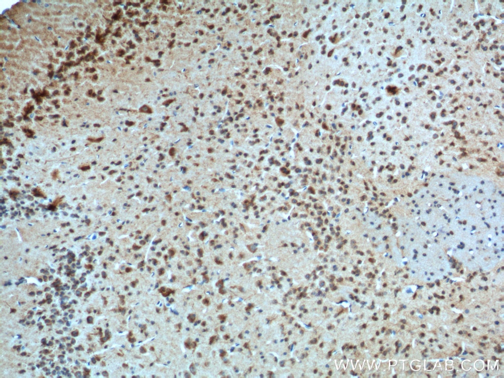 Immunohistochemistry (IHC) staining of mouse brain tissue using Adenosine A1 Receptor Polyclonal antibody (20332-1-AP)