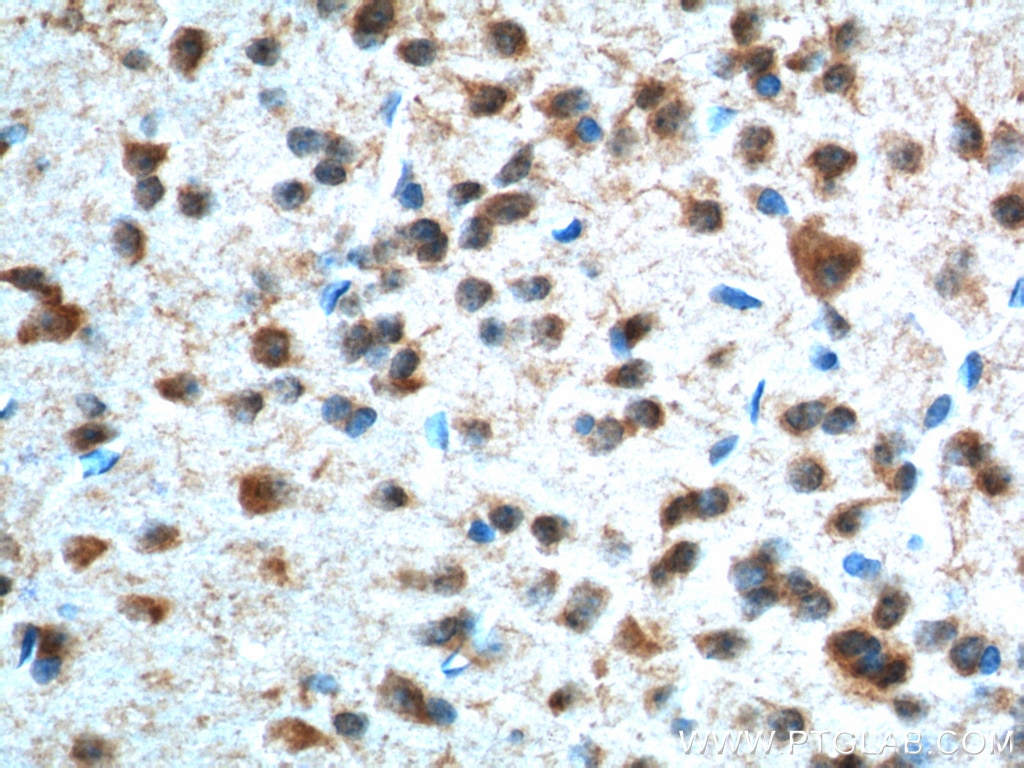 Immunohistochemistry (IHC) staining of mouse brain tissue using Adenosine A1 Receptor Polyclonal antibody (20332-1-AP)