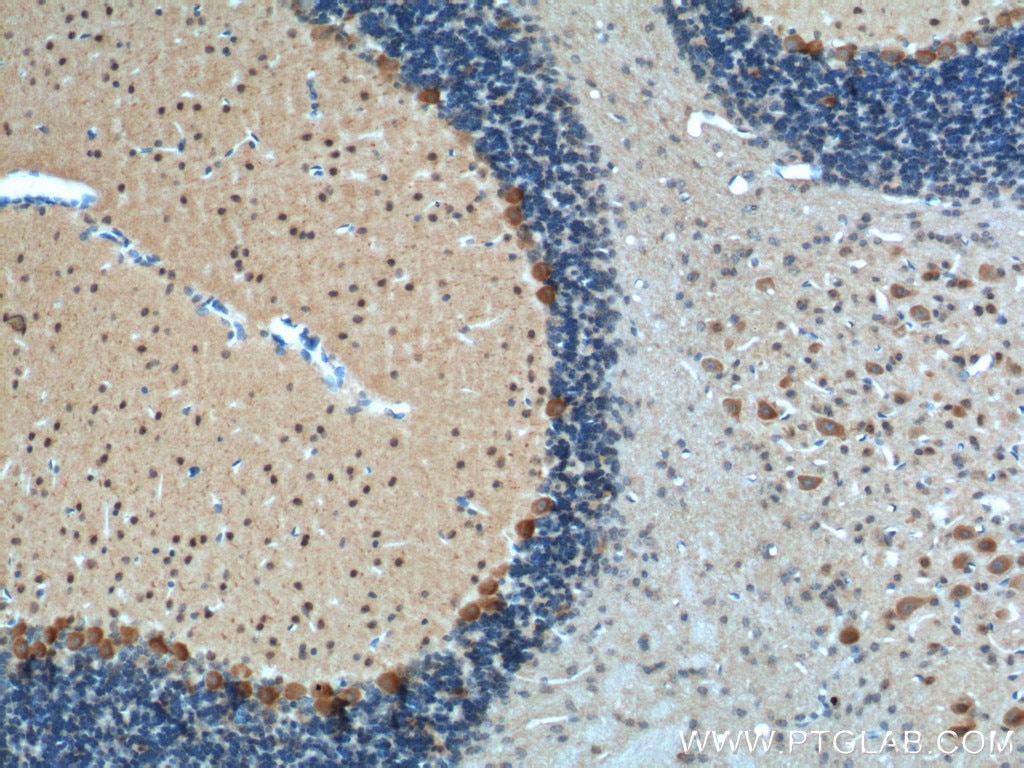Immunohistochemistry (IHC) staining of mouse cerebellum tissue using Adenosine A1 Receptor Polyclonal antibody (20332-1-AP)