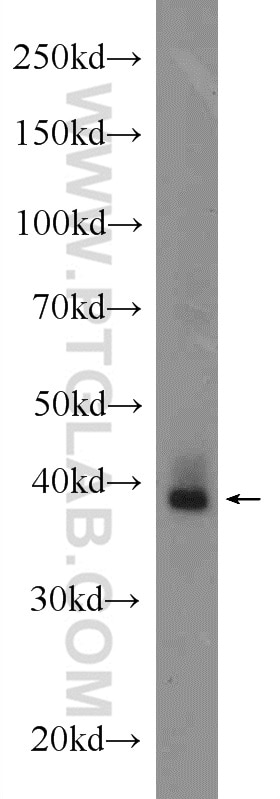 Western Blot (WB) analysis of mouse eye tissue using Adenosine A1 Receptor Polyclonal antibody (20332-1-AP)