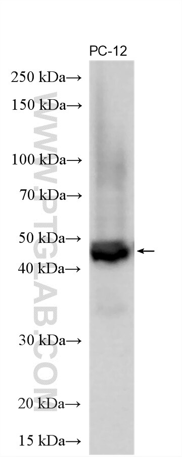 Western Blot (WB) analysis of various lysates using Adenosine A1 Receptor Polyclonal antibody (20332-1-AP)