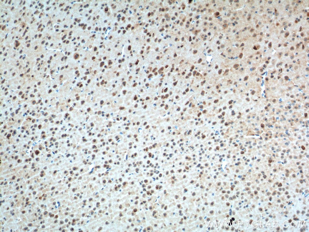 Immunohistochemistry (IHC) staining of mouse brain tissue using Adenosine A1 Receptor Polyclonal antibody (55026-1-AP)