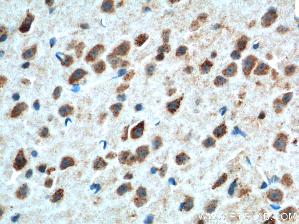 Immunohistochemistry (IHC) staining of mouse brain tissue using Adenosine A1 Receptor Polyclonal antibody (55026-1-AP)