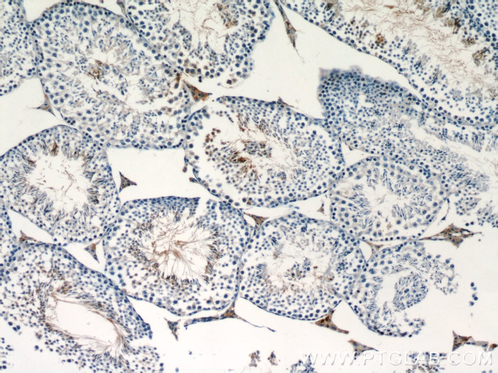 Immunohistochemistry (IHC) staining of mouse testis tissue using Adenosine A1 Receptor Polyclonal antibody (55026-1-AP)