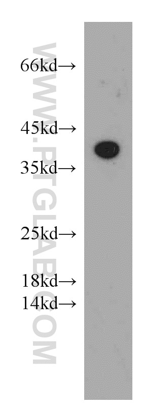Western Blot (WB) analysis of SH-SY5Y cells using Adenosine A1 Receptor Polyclonal antibody (55026-1-AP)