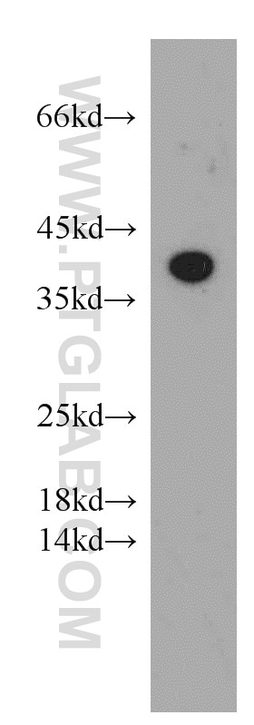 WB analysis of SH-SY5Y using 55026-1-AP