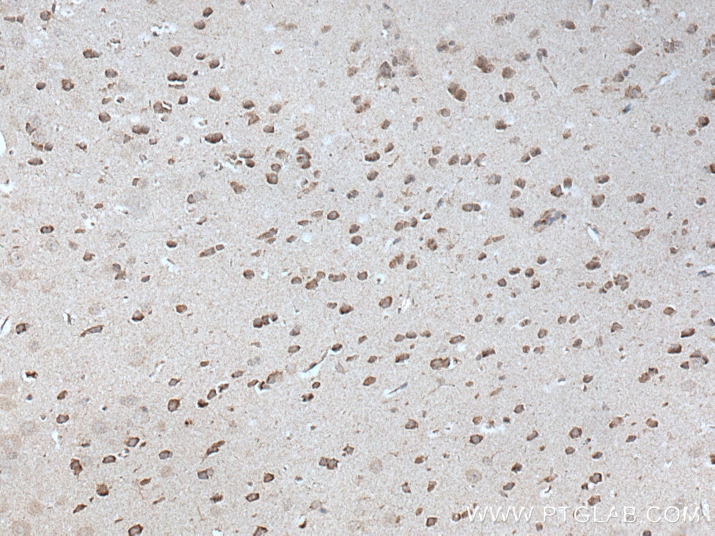 Immunohistochemistry (IHC) staining of mouse brain tissue using ADORA2A Polyclonal antibody (51092-1-AP)