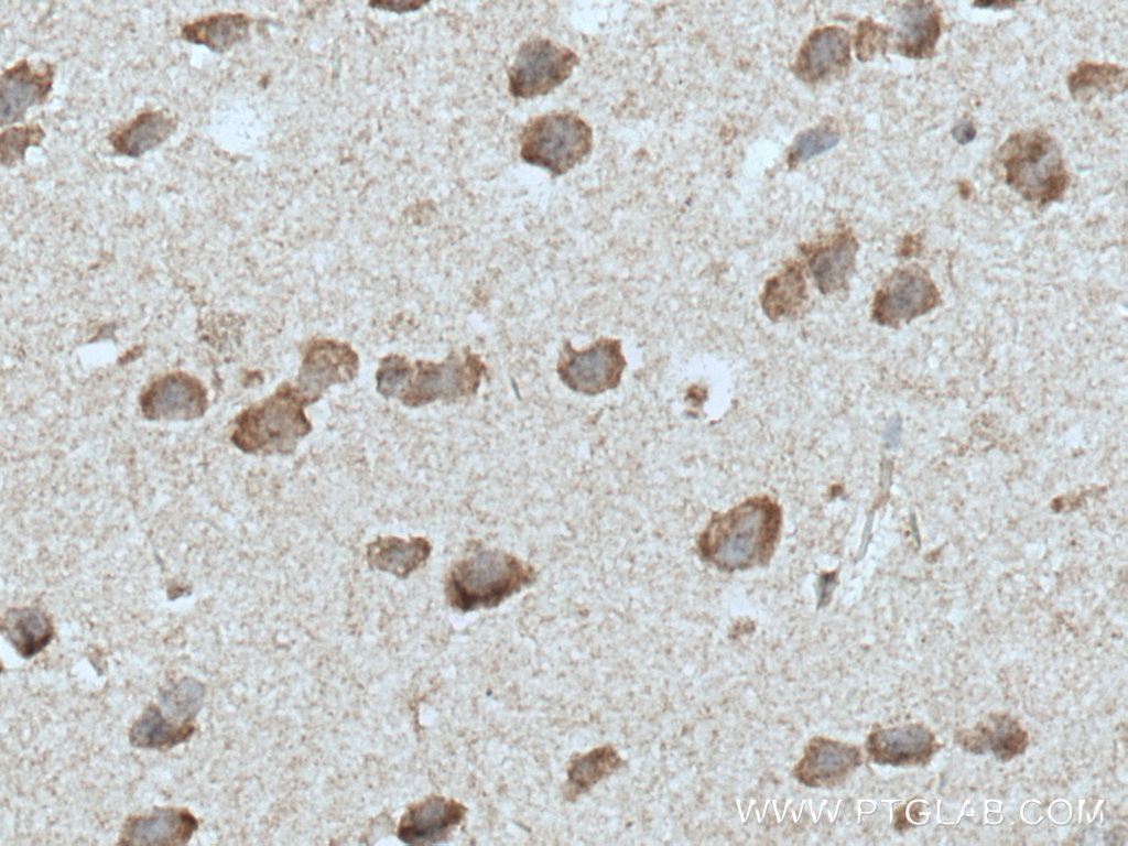 Immunohistochemistry (IHC) staining of mouse brain tissue using ADORA2A Polyclonal antibody (51092-1-AP)