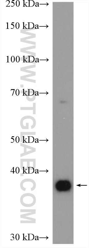 Western Blot (WB) analysis of mouse brain tissue using ADORA2B Polyclonal antibody (21071-1-AP)