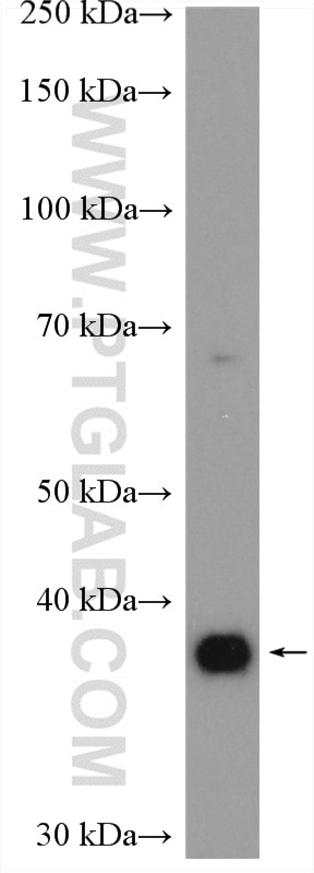 WB analysis of mouse brain using 21071-1-AP