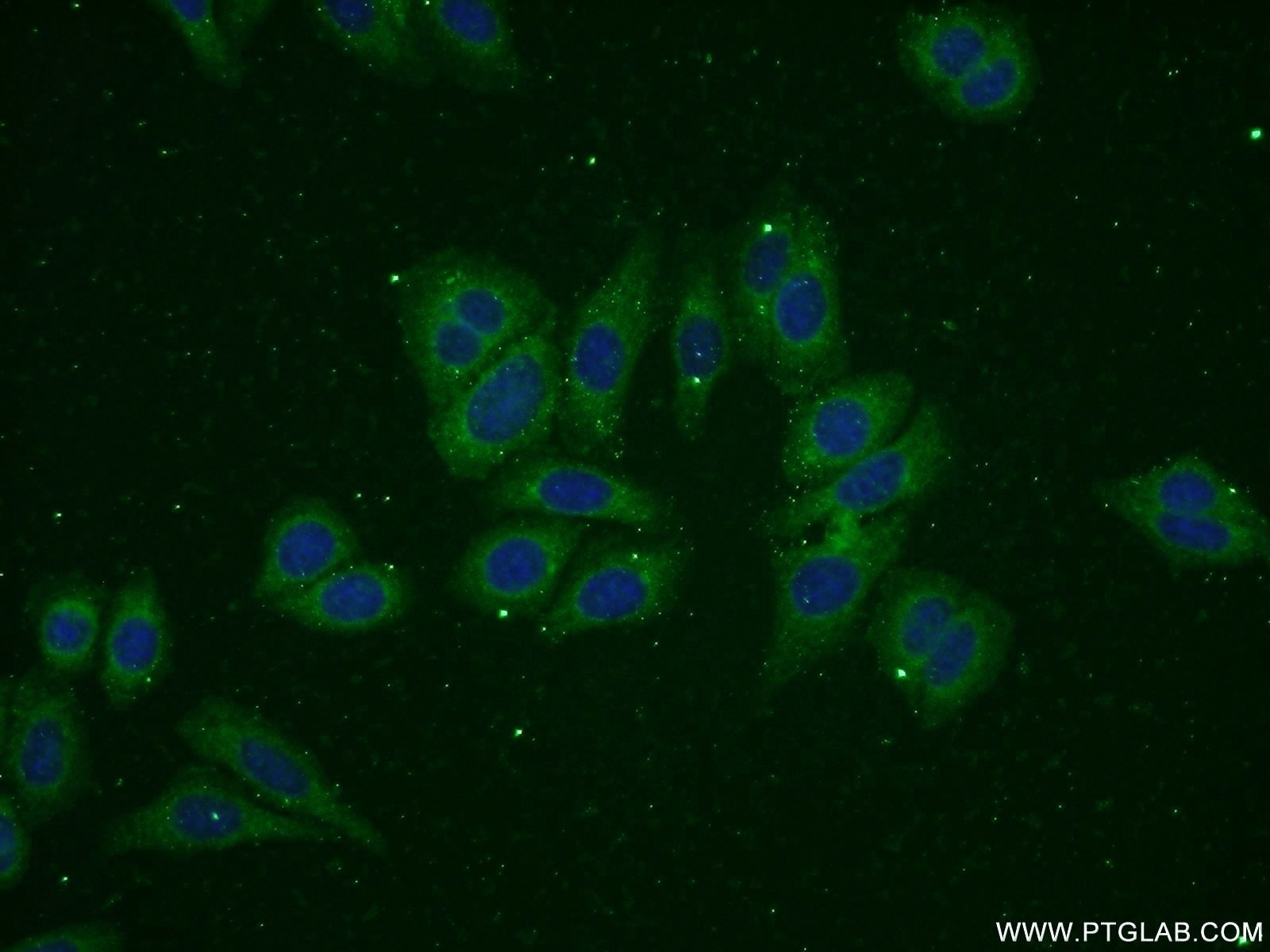 Immunofluorescence (IF) / fluorescent staining of HepG2 cells using ADPGK Polyclonal antibody (15639-1-AP)