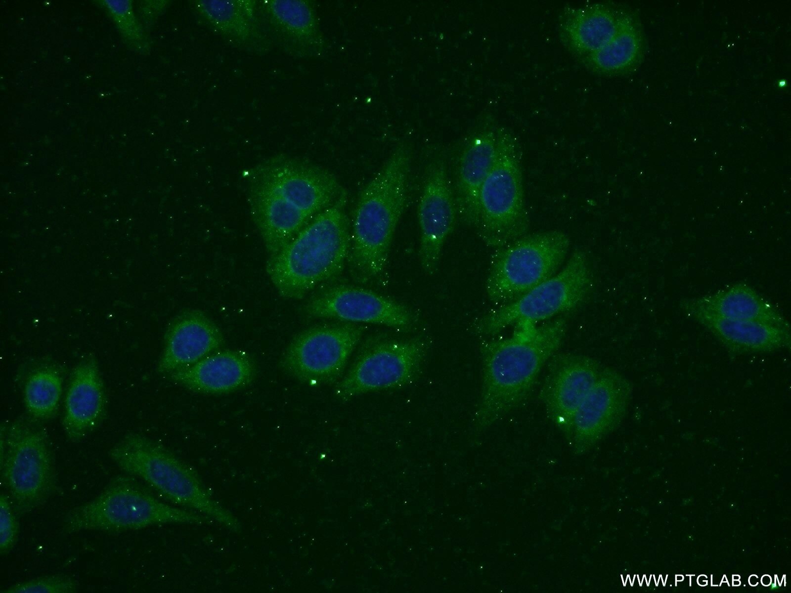 IF Staining of HepG2 using 15639-1-AP