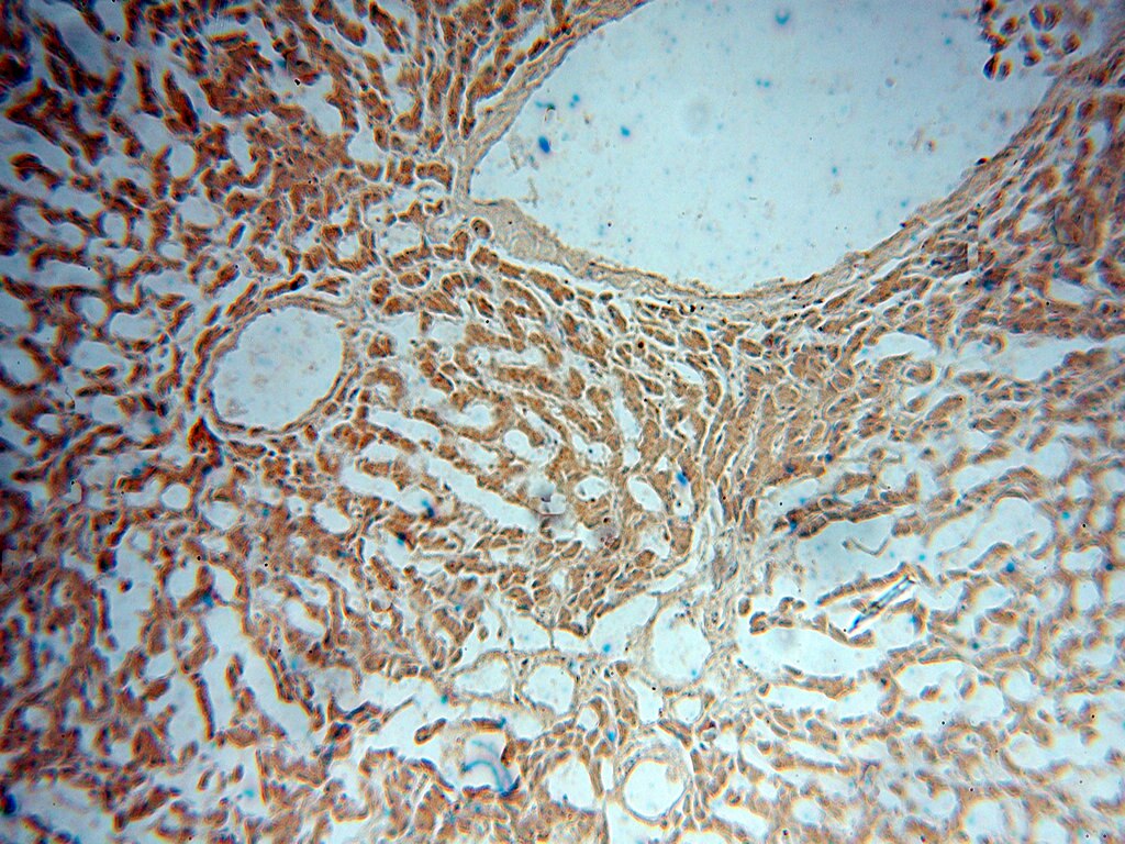 Immunohistochemistry (IHC) staining of human liver tissue using ADPGK Polyclonal antibody (15639-1-AP)