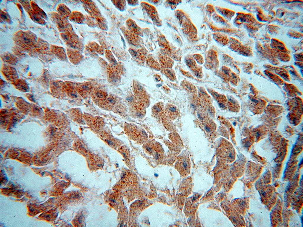 Immunohistochemistry (IHC) staining of human liver tissue using ADPGK Polyclonal antibody (15639-1-AP)