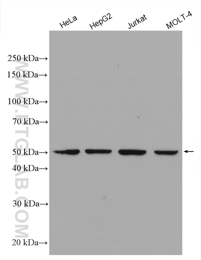 Western Blot (WB) analysis of various lysates using ADPGK Polyclonal antibody (15639-1-AP)