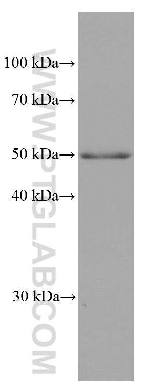 Western Blot (WB) analysis of human placenta tissue using ADPGK Monoclonal antibody (68034-1-Ig)