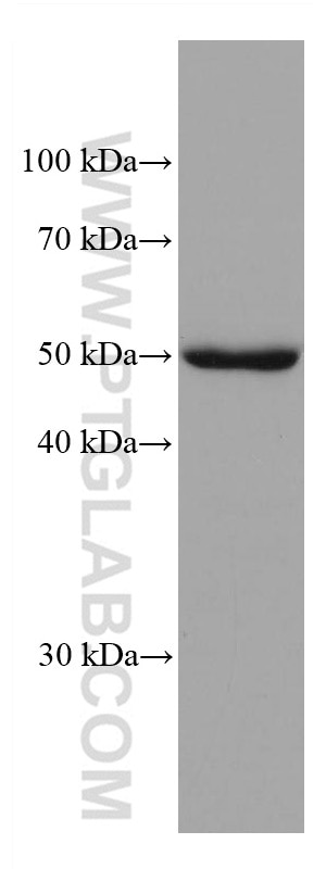 Western Blot (WB) analysis of A549 cells using ADPGK Monoclonal antibody (68034-1-Ig)