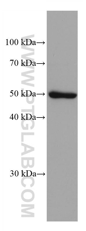 Western Blot (WB) analysis of LNCaP cells using ADPGK Monoclonal antibody (68034-1-Ig)