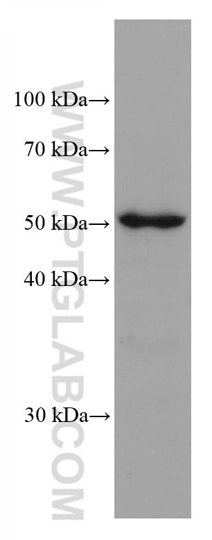 Western Blot (WB) analysis of HeLa cells using ADPGK Monoclonal antibody (68034-1-Ig)
