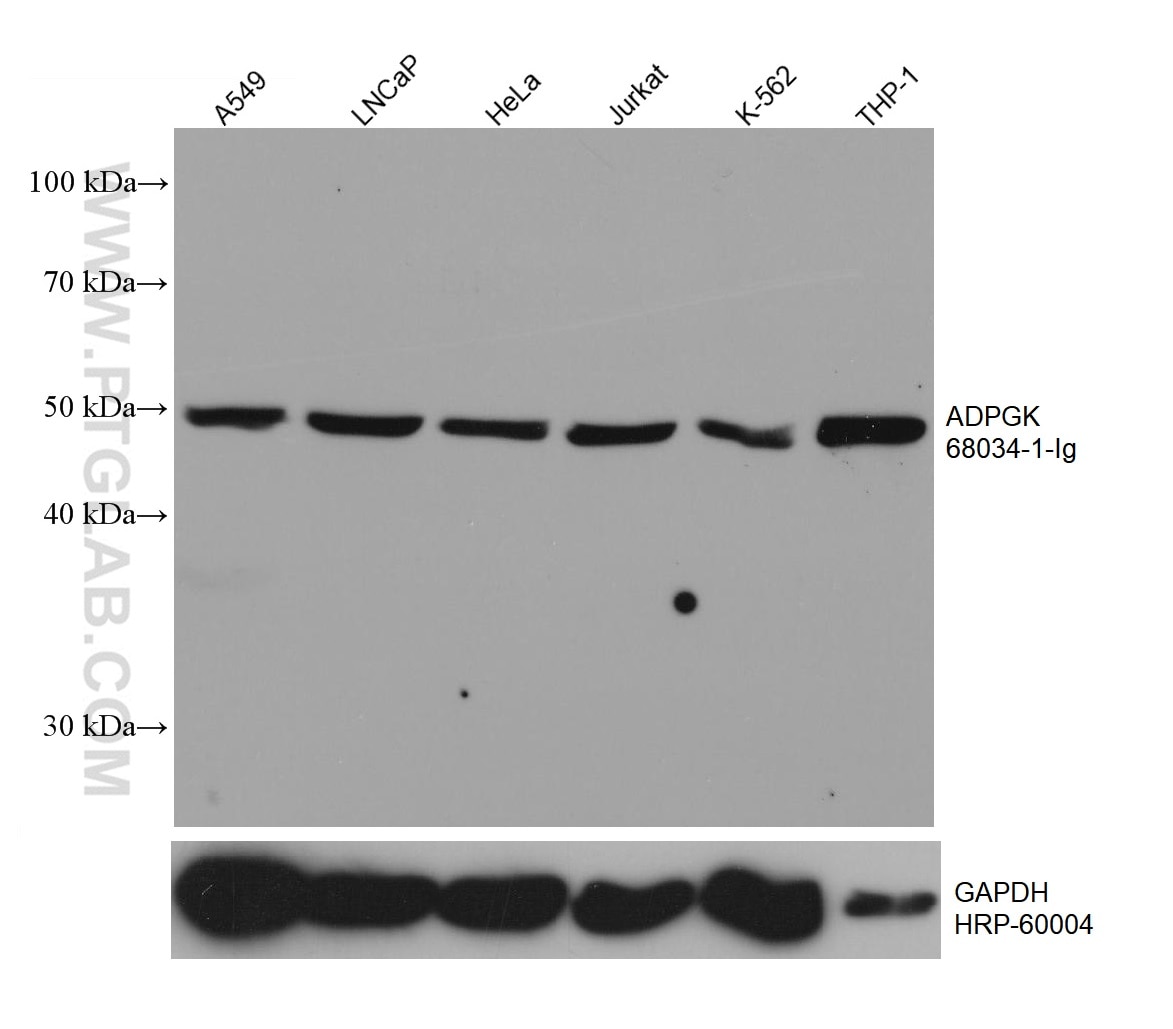 Western Blot (WB) analysis of various lysates using ADPGK Monoclonal antibody (68034-1-Ig)