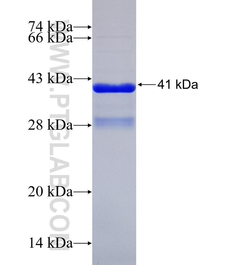 ADPGK fusion protein Ag31225 SDS-PAGE